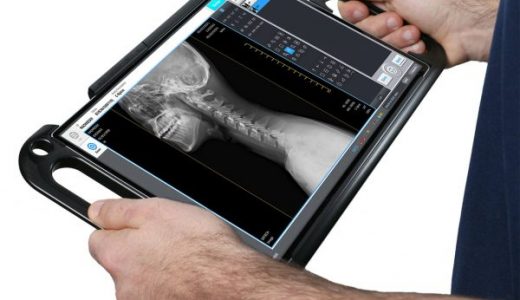 Acuity 10×12 Wireless DR Panel