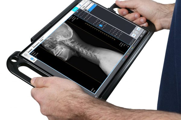 Acuity 10×12 Wireless DR Panel